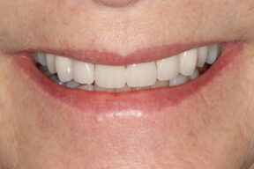 Cosmetic dentist in North Yorkshire, England, UK